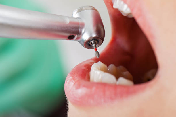 Best Weekend Emergency Dentist in Tipton, CA